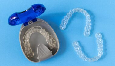 Say Goodbye to Ugly Braces With makeO toothsi Clear Aligners